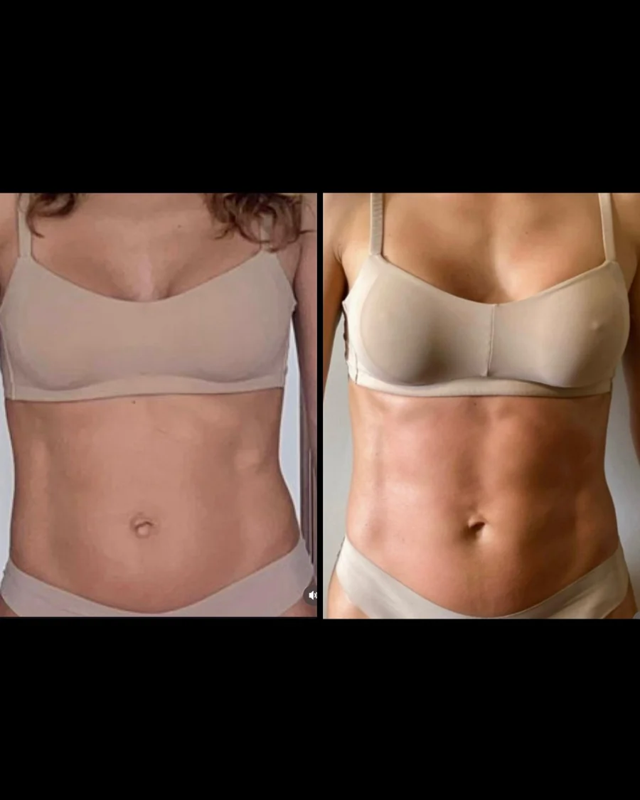 Antes e depois 1