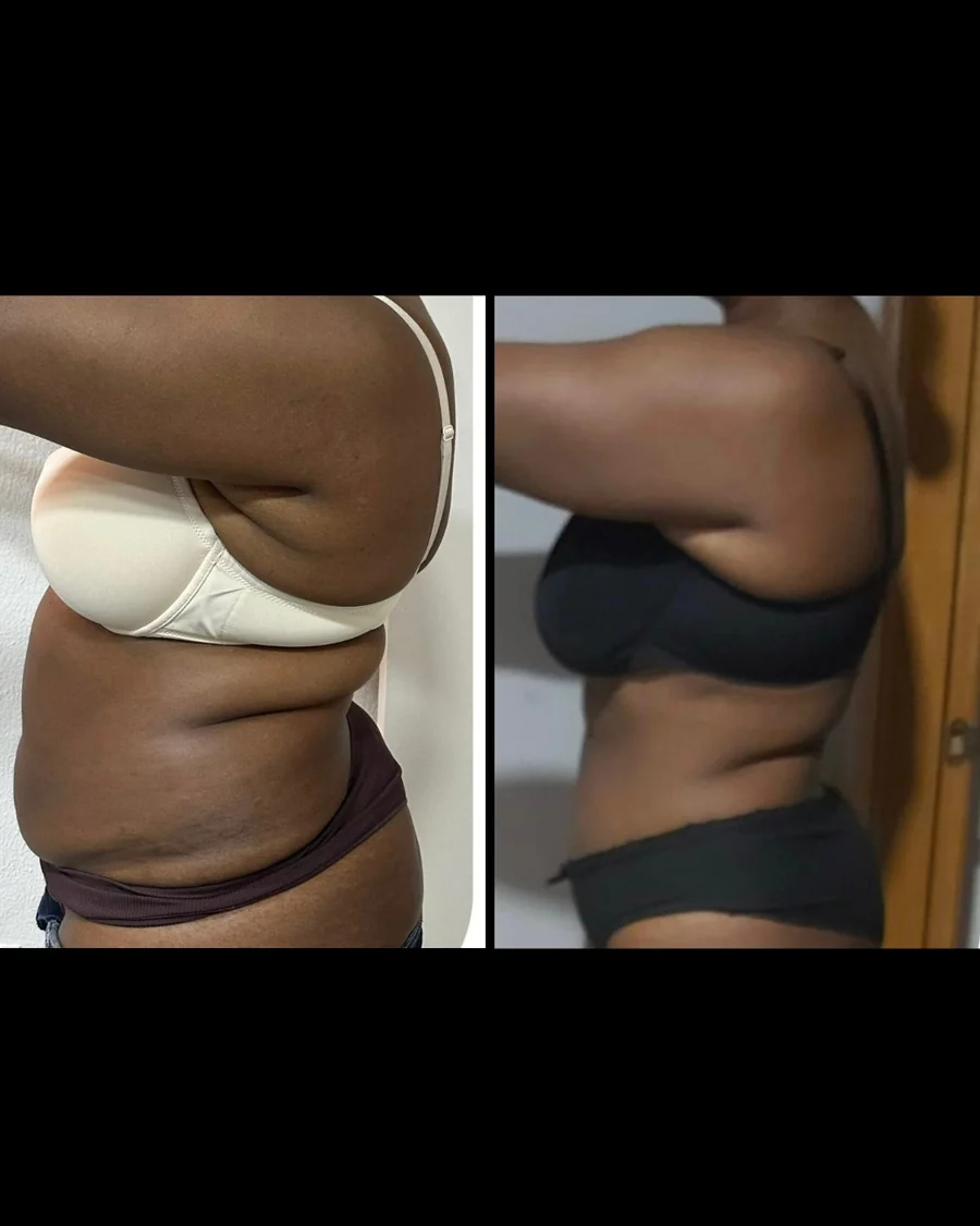 Antes e depois 2