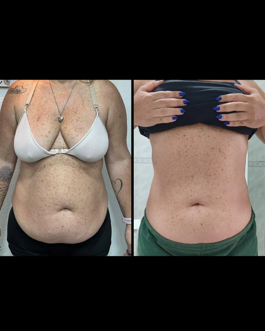 Antes e depois 3