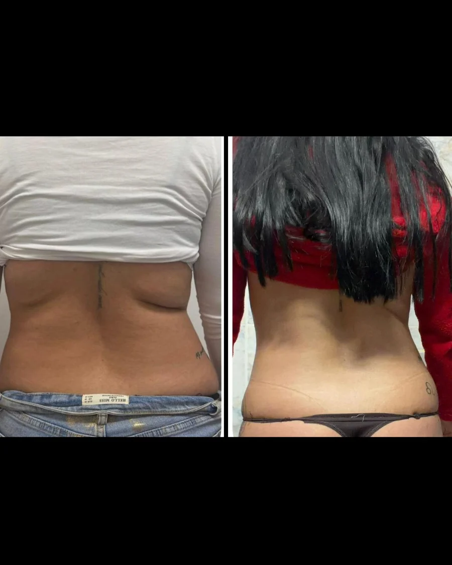 Antes e depois 4