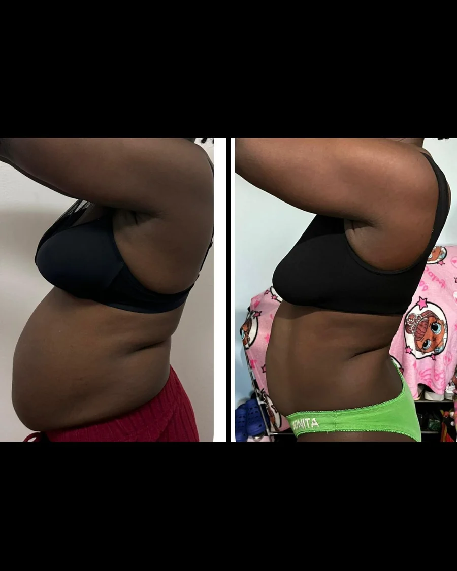 Antes e depois 5