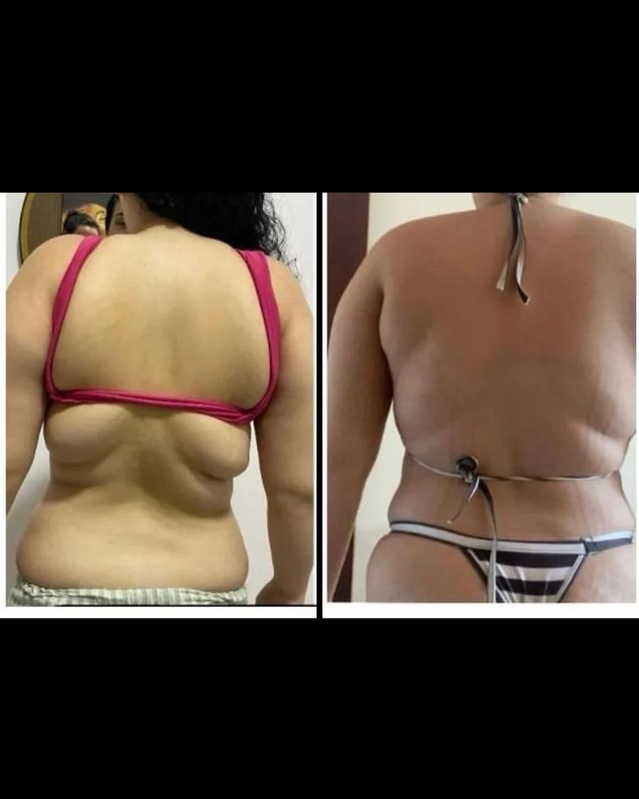 Antes e depois 6
